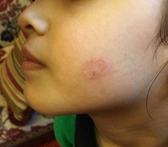 Female teacher punishes students by burning them on sensitive parts